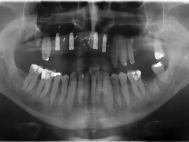 Abb. 29: OPG post OP.