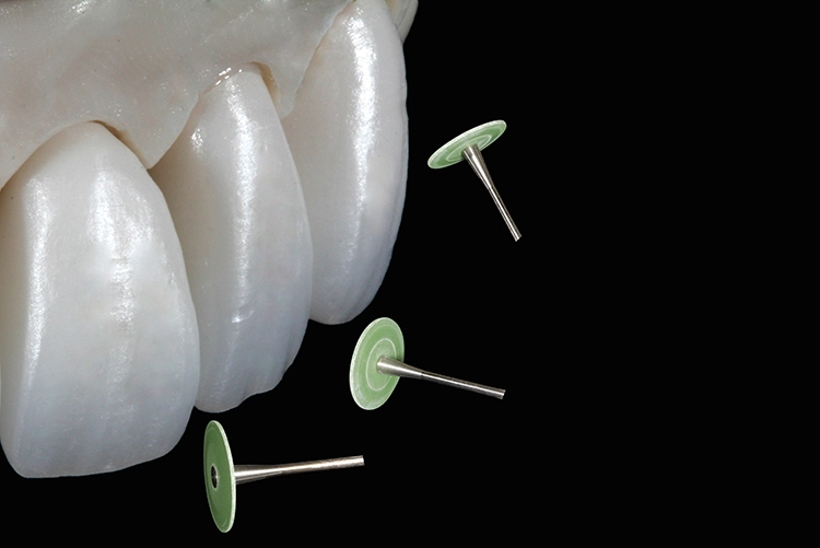 Abb. 4: Gestaltung der Oberfläche mit einem Diamantgummi.