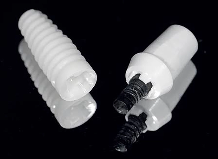Abb. 4a: Zweiteiliges Zeramex XT Implantat mit einer carbonfaserverstärkten Vicarbo®-Schraube.