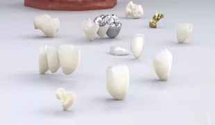 COMPLEO bietet den vollen Zugriff auf gängige Materialien für den Zahnersatz.