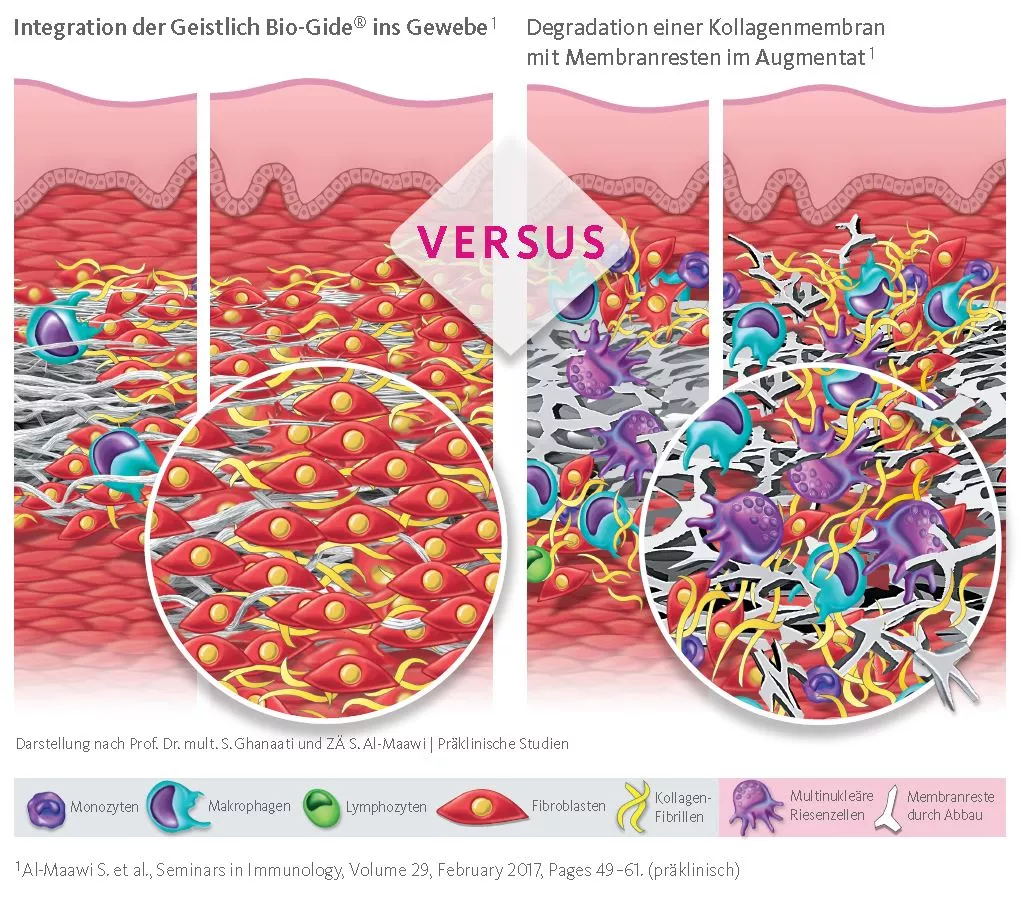 Schematische Gegenüberstellung der Integrations- und Degradationsmuster nach Prof. Dr. mult. S. Ghanaati und ZÄ S. Al-Maawi, Präklinische Studien.