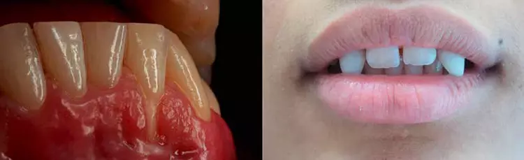 Gewinnerfotos beim EFP-Wettbwerb 2018 in den Kategorien „Dental Desease“,
