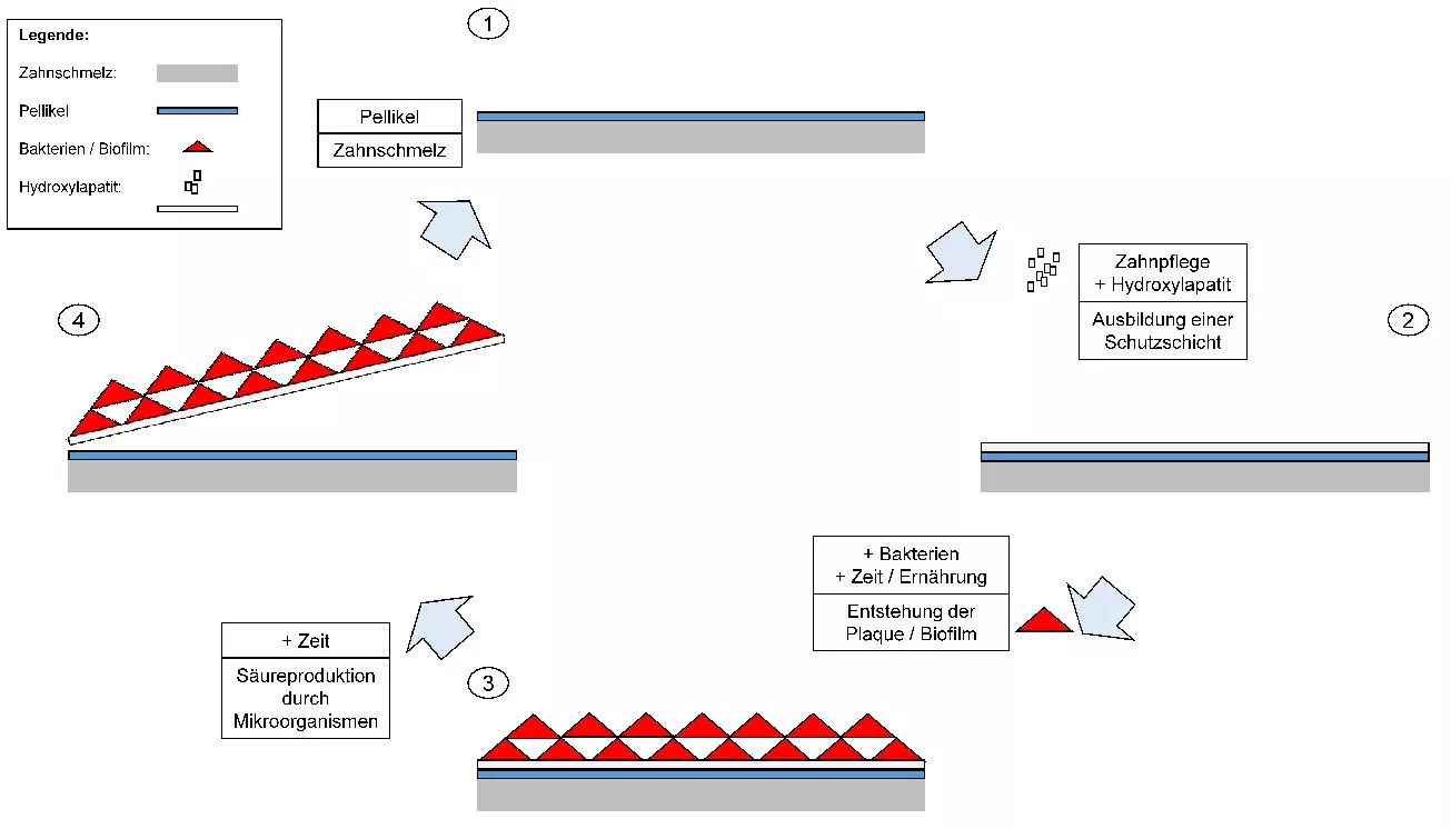 Nach dem Zähneputzen ist im Optimalfall die gesamte Plaque entfernt. Der Zahnschmelz ist von dem Pellikel bedeckt (1). Nach Anwendung einer Zahnpasta mit Hydroxylapatit bildet sich eine Schutzschicht auf dem Zahnschmelz / Pellikel aus (2). Auf dieser Schutzschicht lagern sich Bakterien und andere Mikroorganismen an die in der Folge ein Plaque / Biofilm bilden (3). Dieser Biofilm kann aus Bestandteilen der Nahrung Säuren fermentieren. Durch die Säureproduktion und durch mechanische Einflüsse kann sich die Plaque zusammen mit der Hydroxylapatit-Schutzschicht von dem Zahnschmelz ablösen (4).