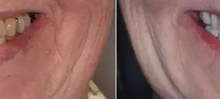 .