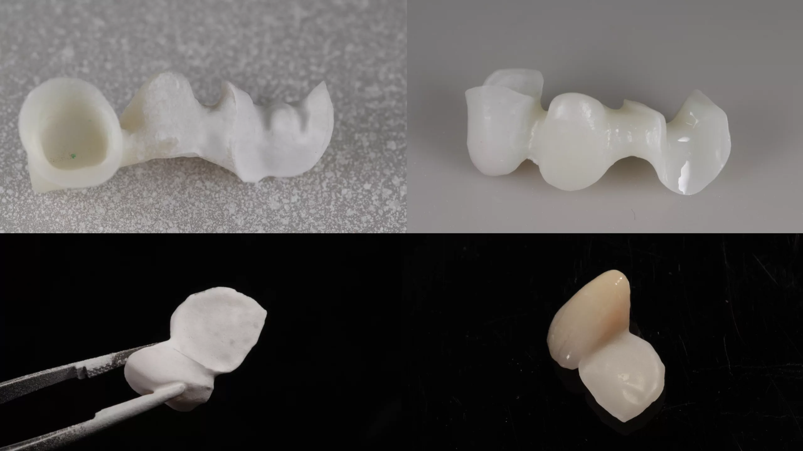 Aufbringen einer ätzbaren Glasmatrix auf das Zirkonoxidgerüst mit DCMhotbond zirconnect.