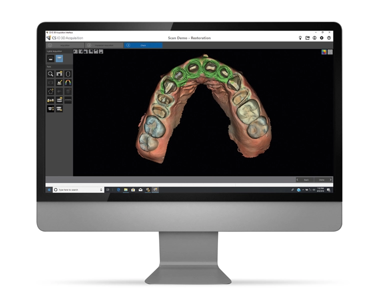 CS 3600 mit neuer Software: Mit dem neuen Hybrid-Scan-Workflow kann eine analoge Abformung mit dem digitalen Scan überlagert und perfektioniert werden.