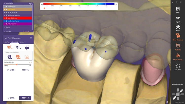 Die neue Softwareversion DentalCAD 3.0 Galway von exocad mit 90 neuen und 80 optimierten Funktionen ist ab sofort verfügbar. Mit der neuen Version führt das Unternehmen das neue Instant Anatomic Morphing ein. Dieses neue Feature ermöglicht eine automatische Anpassung der Zähne in Echtzeit, was die Geschwindigkeit und Präzision der anatomischen Zahnplatzierung erheblich verbessert.
