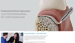 Die neue Patientenwebsite informiert über Knochenaufbau: www.dentsplysirona.com/knochenaufbau