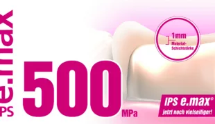 IPS e.max-Lithium-Disilikat: durchschnittliche biaxiale Biegefestigkeit von 500 MPa.