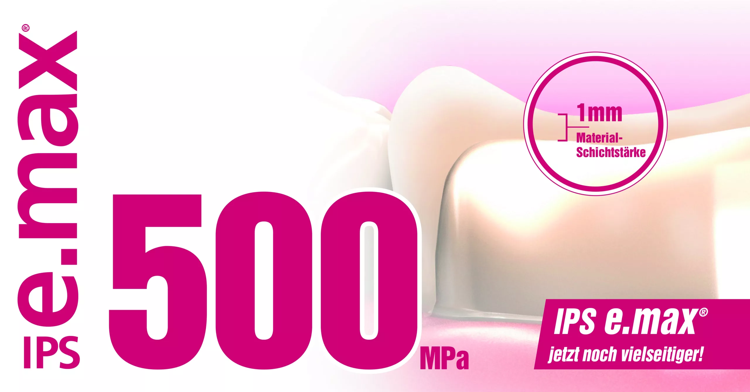 IPS e.max-Lithium-Disilikat: durchschnittliche biaxiale Biegefestigkeit von 500 MPa.