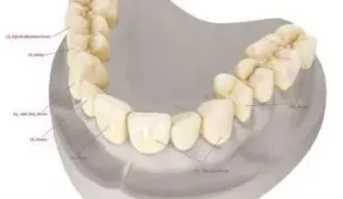 IPS e.max®: All ceramic – all you need.