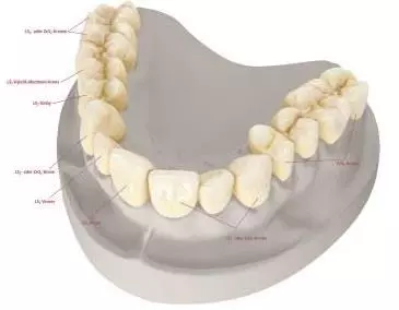 IPS e.max®: All ceramic – all you need.