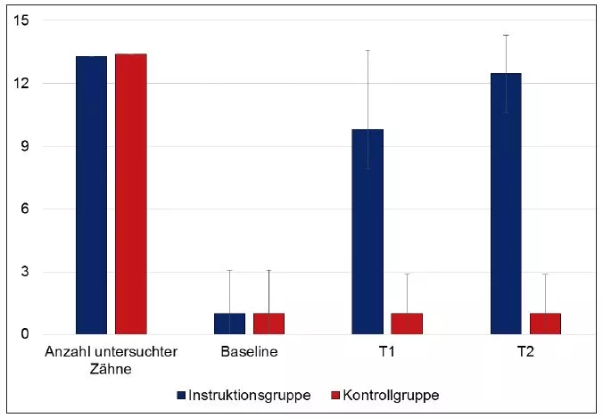 Abb. 6: Effektivität einer videobasierten und individuellen Instruktion zum Erlernen der Zahnseidennutzung bei 197 Personen im Alter zwischen 18 und 65 Jahren (mittleres Alter: 28,5 Jahre). Den Probanden einer Instruktionsgruppe
(n=86) wurde in einem ersten Termin ein Video mit der korrekten Nutzung von Zahnseide gezeigt (T1). In einem weiteren Termin erhielten die Probanden eine erneute Videoinstruktion sowie zusätzlich eine individuelle Instruktion (T2). Diese Gruppe wurde mit einer Kontrollgruppe (n=111) verglichen, die weder das Video gesehen hat noch individuell instruiert wurde. Die Anzahl der untersuchten Zähne war in beiden Gruppen gleich und betrug etwa 13. Es ist deutlich zu
sehen, dass in der Instruktionsgruppe bereits nach nur einmaligem Schauen des Videos mehr Zähne korrekt mit Zahnseide gereinigt wurden als in der Kontrollgruppe;
dieser Effekt konnte durch das nochmalige Schauen des Videos und die individuelle Instruktion weiter gesteigert werden (Daten aus [14]).