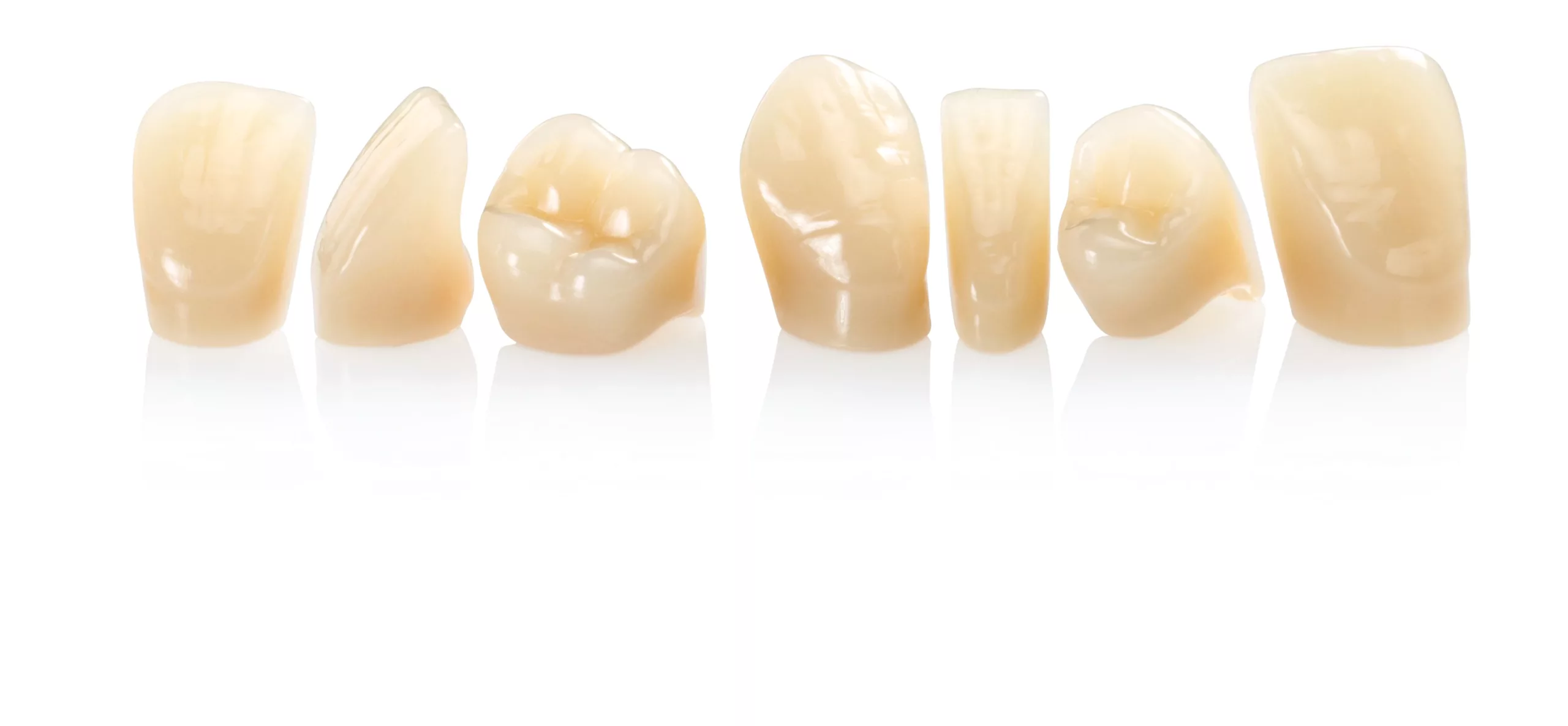 Die neuen SR Vivodent S DCL Zahnlinien von Ivoclar Vivadent.