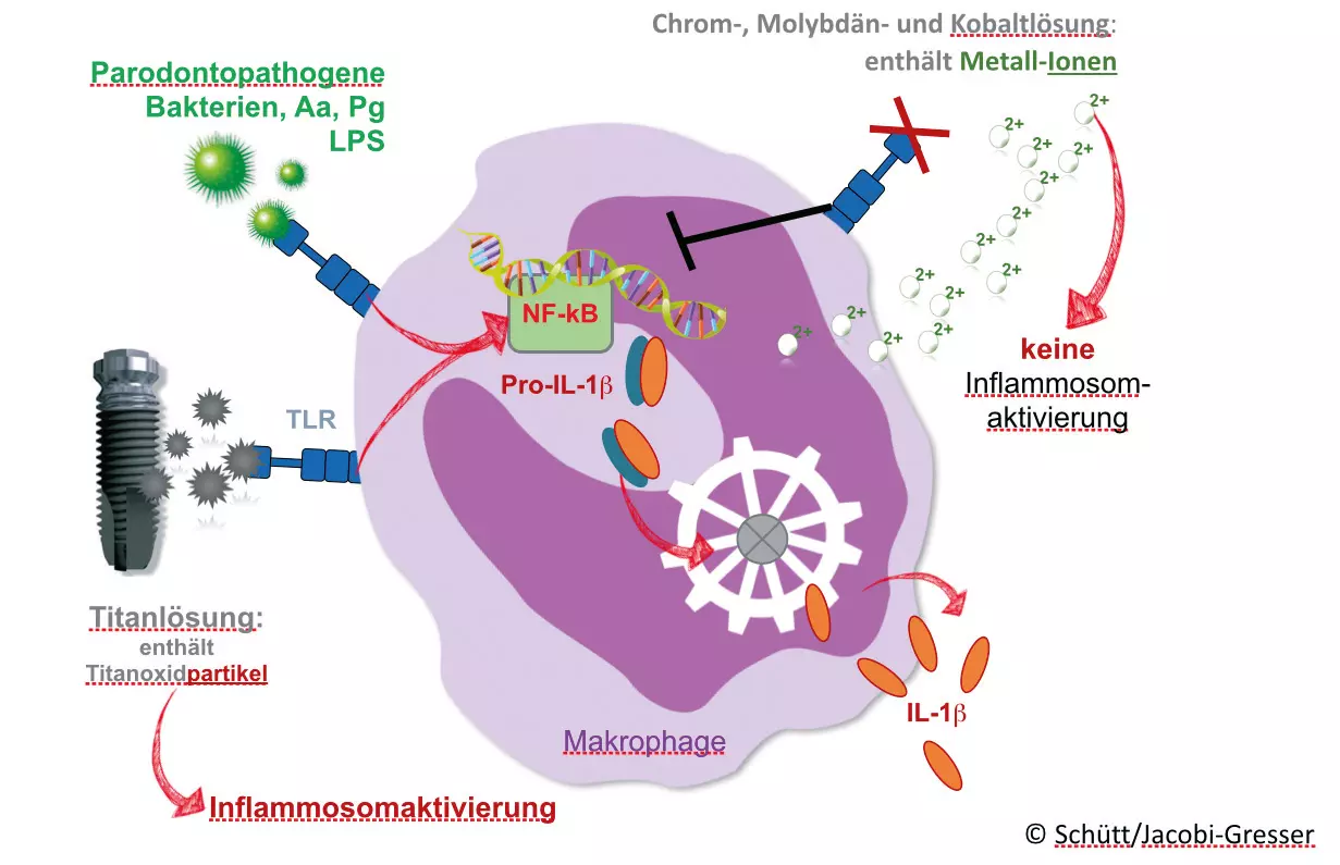 Abb. 4: Modell der Inflammasom-Aktivierung in Makrophagen durch LPS von Bakterien und durch Titanpartikel.