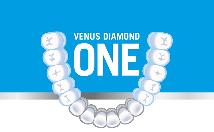 Ein abgestimmtes System! Das Komplettpaket für die täglichen Restaurationen – Venus Diamond ONE Basis Kit – enthält Venus Diamond ONE, Venus Diamond Flow Baseliner und iBOND Universal.