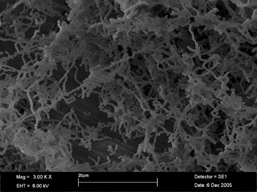 Auch der Hauptverursacher von Karies, Streptococcus mutans, kann Resistenzen gegen das Antiseptikum Chlorhexidin bilden.