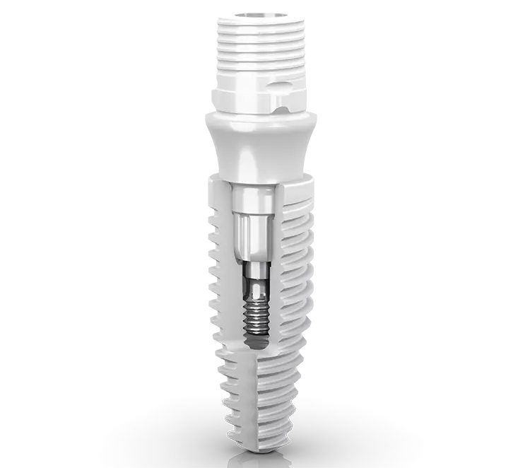 Das Keramik-Implantat von Neodent® der Straumann Group.