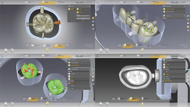 Neue Prozessoptionen und Analysefunktionen mit inLab CAM SW 19.0: individuelles Anstiften, Überprüfung der Wandstärke, Simulation von Produktionsergebnissen, werkzeuggerechte Passflächenbearbeitung und vieles mehr.