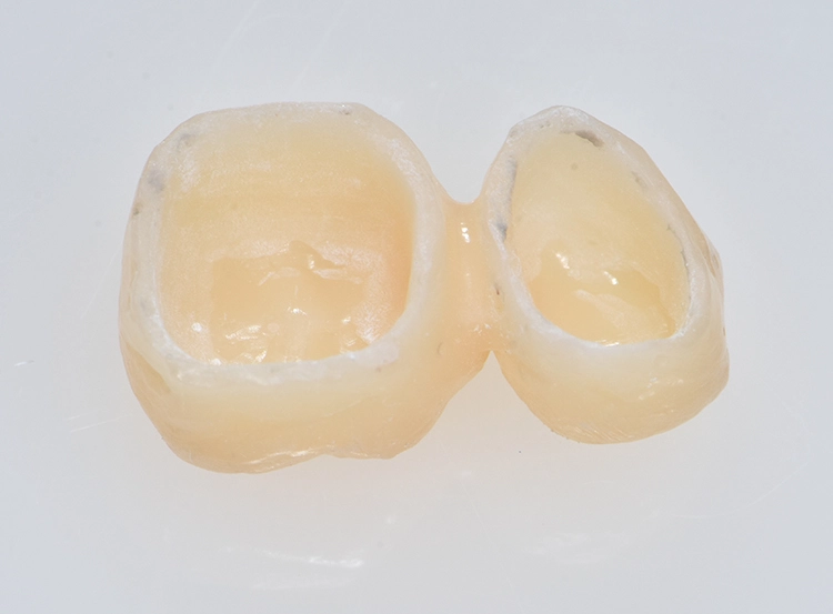 Abb. 10c: Intaglio-Oberfläche nach der Endbearbeitung und Politur, die glatte Ränder zeigt.