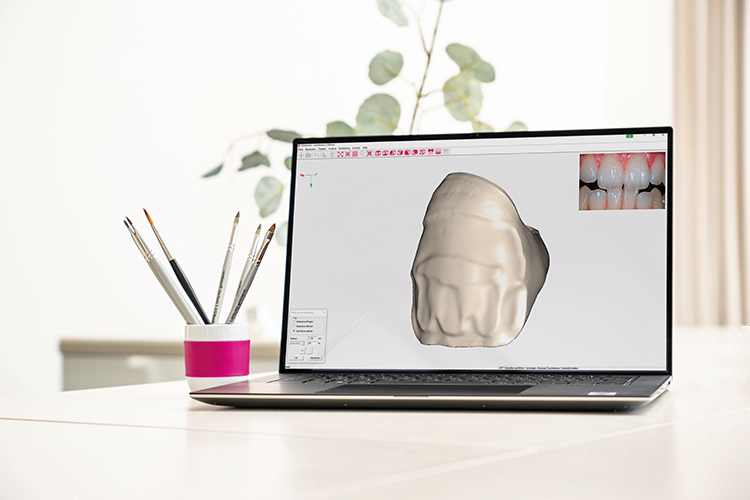 ceraMotion® CADback, die neue Stand-Alone-Software speziell für Keramiker.