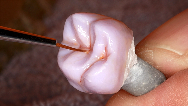 Im Webinar vielbeachtet waren die Malkurse zur Steigerung und Individualisierung der Ästhetik diverser Restaurationswerkstoffe (hier e.max CAD vor Kristallisierung).
