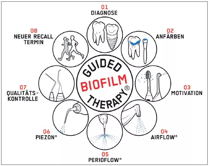 Das Schema zur Guided Biofilm Therapy (GBT).