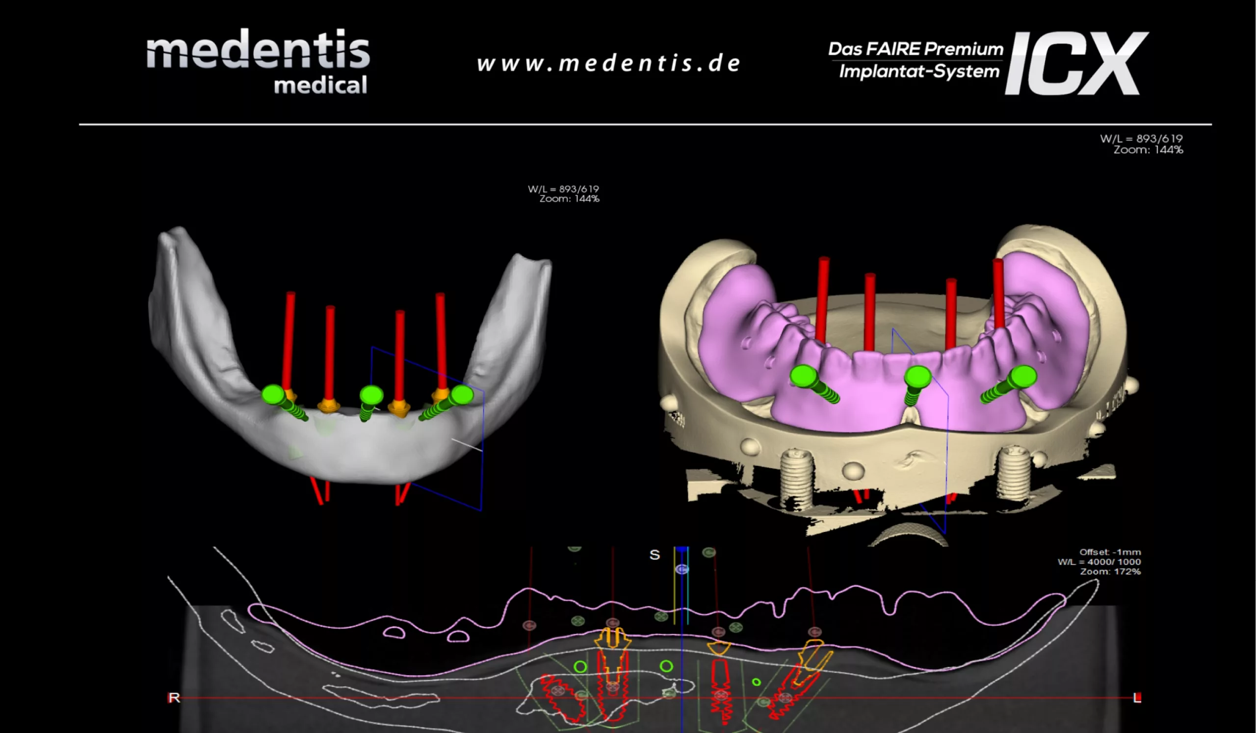 © medentis medical