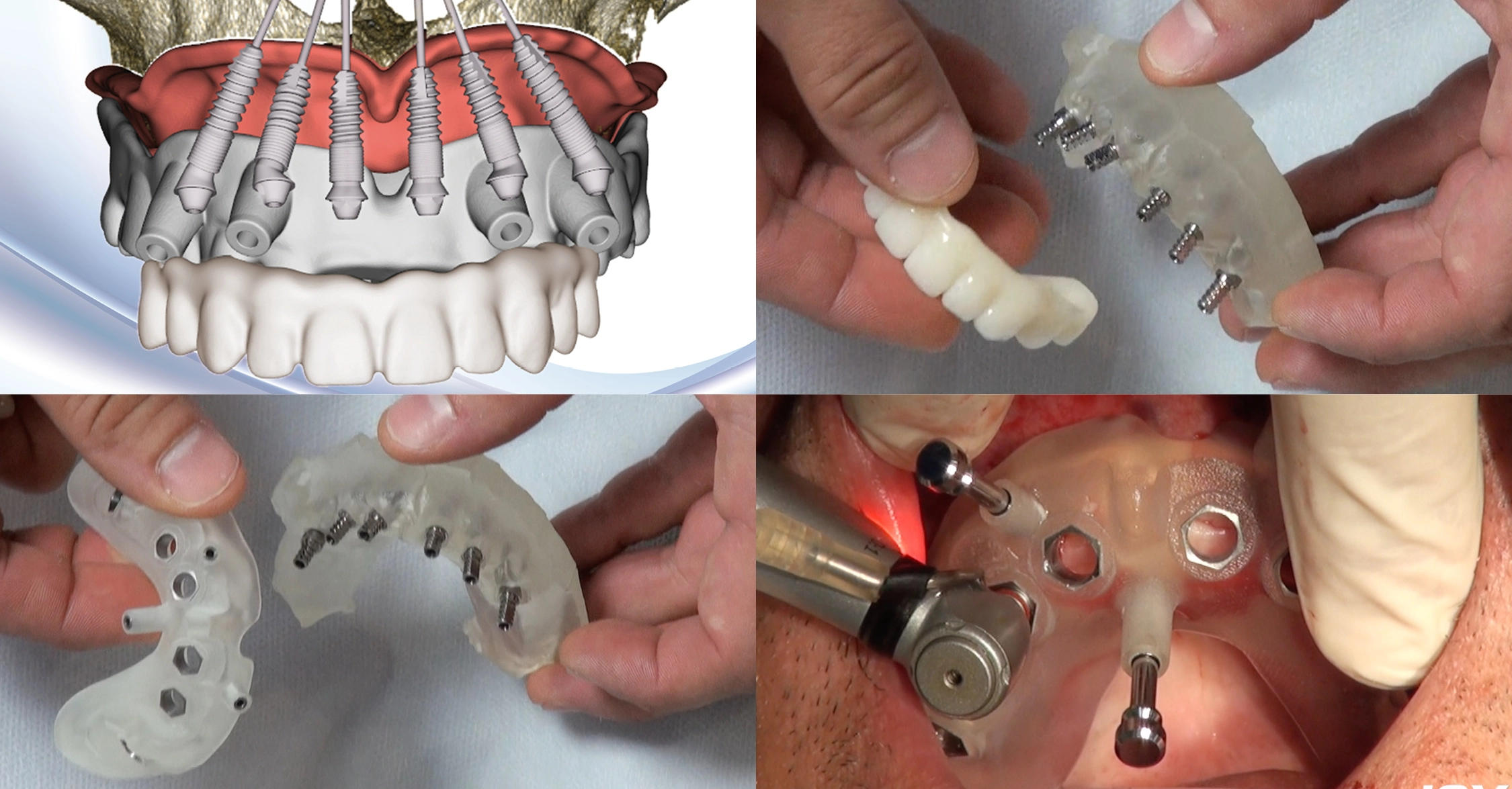 © medentis medical