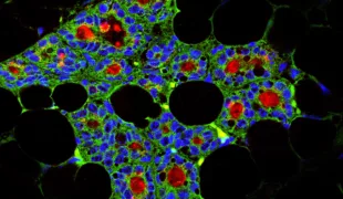 Schnitt durch eine Milchdrüse, die von dentalen Stammzellen erzeugt wurde (grün: Zahnepithelzellen, blau: Zellkerne, rot: milchspezifisches Protein Kasein).