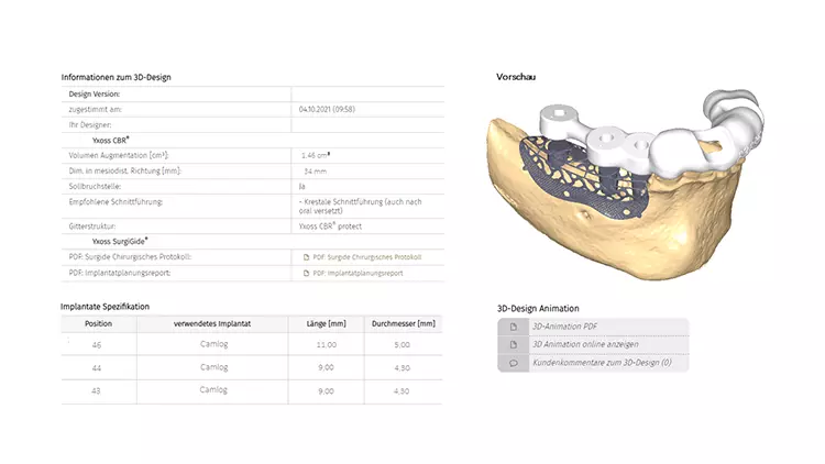 Abb. 1: Kombination aus Bohrschablone und Yxoss CBR® mit allen Detailinformationen wie Augmentationsvolumen und geplante Implantatdurchmesser.