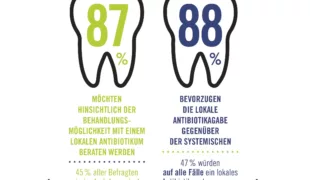Repräsentative Umfrage von Kantar GmbH, 614 befragte Parodontitis-Betroffene, Januar 2020. © Kulzer GmbH