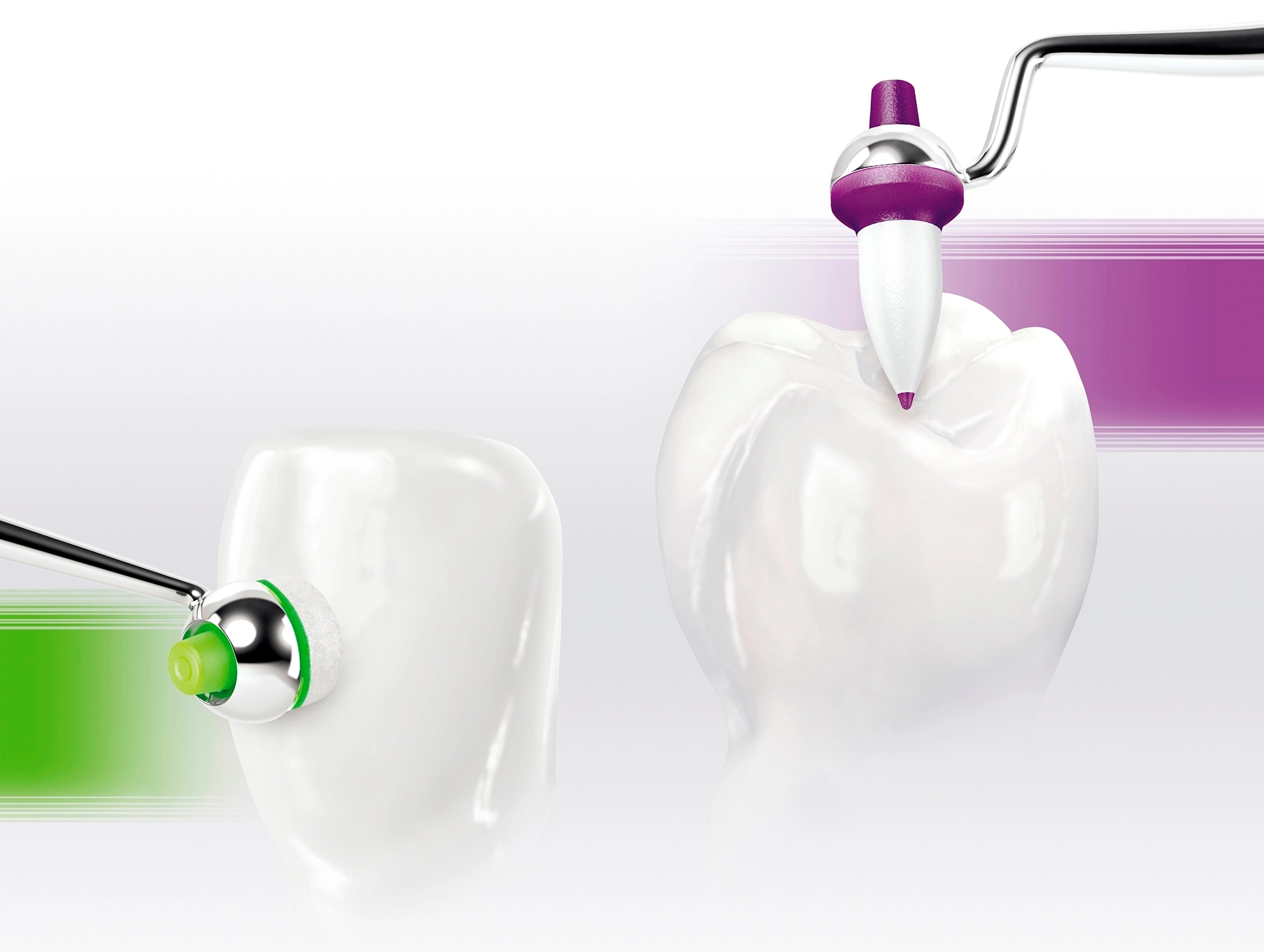 Als Ergänzung zum beliebten OptraSculpt Pad für den Frontzahnbereich ist nun das OptraSculpt® Next Generation für den Seitenzahnbereich erhältlich.