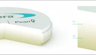Erhältlich sind die neuen Nacera® Pearl Q³ Zirkonoxid Blanks in A – C (Light und Dark).