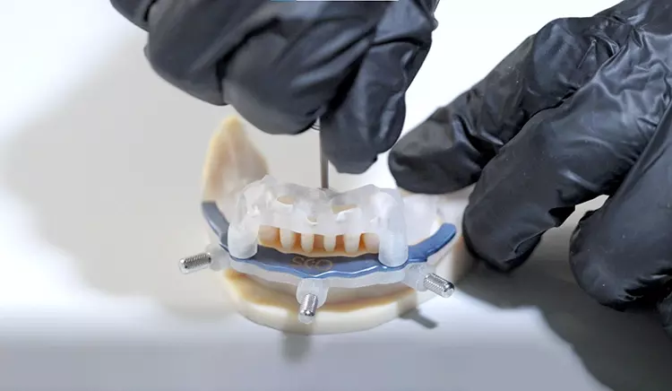 Die DentaJet-3D-Drucker von Stratasys nutzen die PolyJet-Technologie mit einem Multimaterial-Ansatz zur Herstellung von Operationsschablonen und modularen.