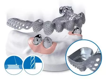 Lernen Sie die Möglichkeiten des CAD/CAM-Hybridverfahren kennen