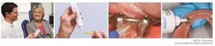 Anwendung von Cervitec® Gel