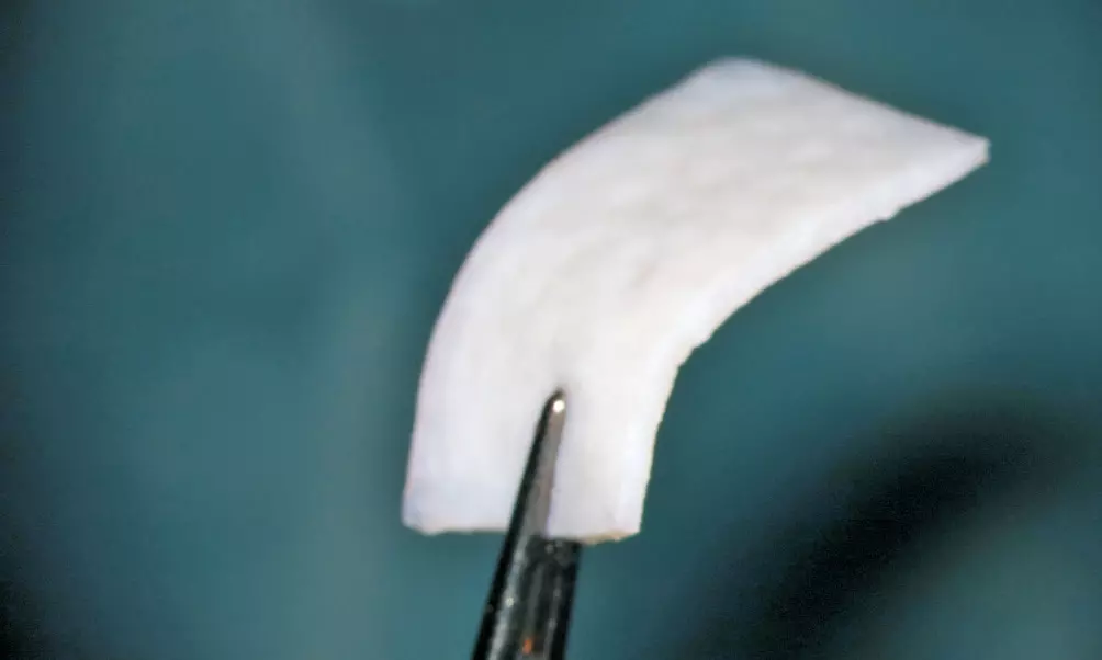 Abb. 2: NovoMatrix, nativ, hydriert aus sterilem Innenblister entnommen.