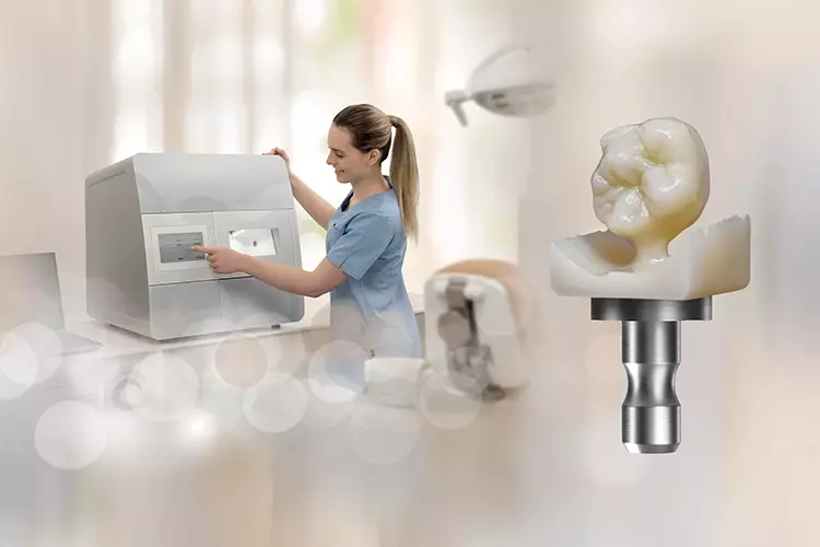 Abb. 1: Molarenkrone aus einem Komposit-/Hybridmaterial mit der neuen Diamond Finish Strategie des Systems Ceramill DRS bearbeitet.