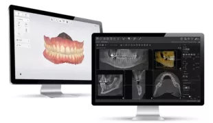 Nahtloser Workflow von 3ShapeUnite (li.) zu VistaSoft von DÜRR DENTAL.
