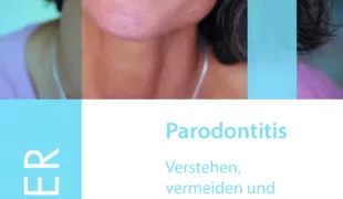 Der neue Patientenratgeber „Parodontitis – Verstehen, vermeiden und behandeln“.