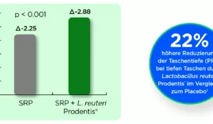 Signifikant höhere Reduzierung der Taschentiefe durch L. reuteri Prodentis® [3].