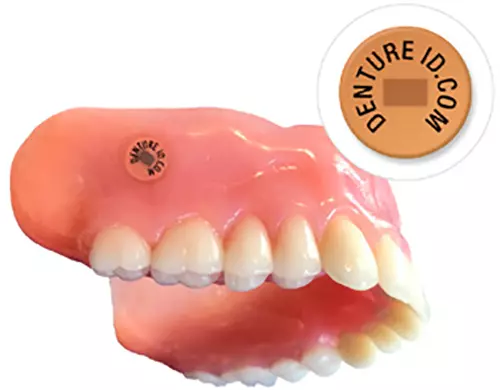 Prothese mit eingebettetem DentureID-Chip.