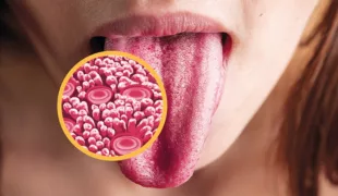 .