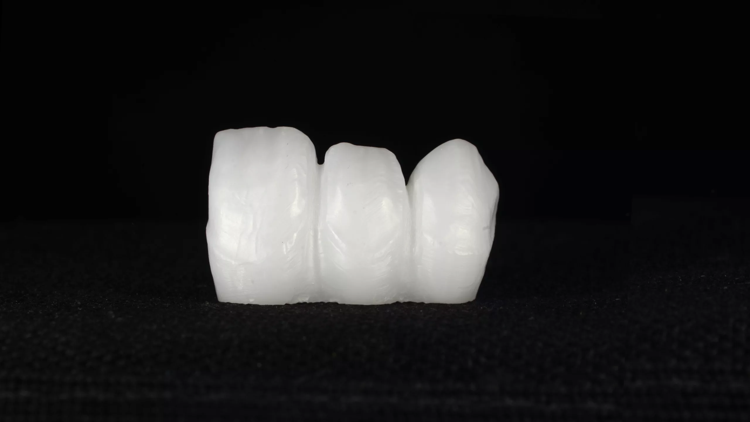 Abb. 26 bis 29: Struktur aus Zirkoniumdioxid und anschließende Applikation verschiedener zahn- und gingivafarbener Lustre Pastes (Initial Lustre Pastes ONE bzw. NF Gum).