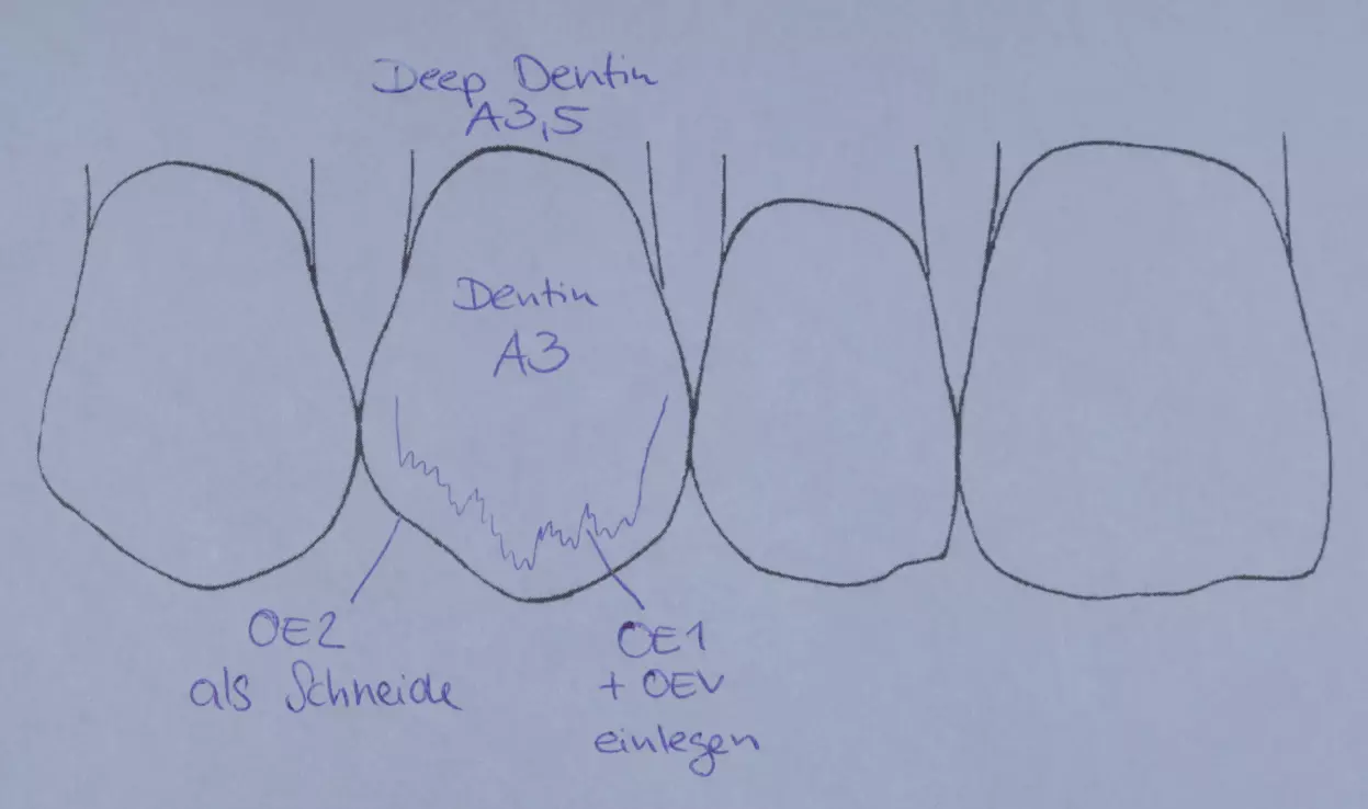 Abb. 8: Schichtschema.