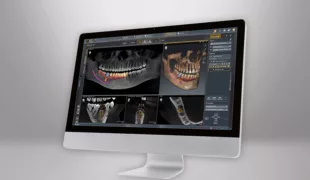 Moderne und intuitive Implantologie mit der neuen SICAT Implant 2.0.