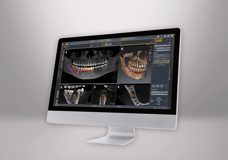 Moderne und intuitive Implantologie mit der neuen SICAT Implant 2.0.