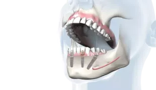 .