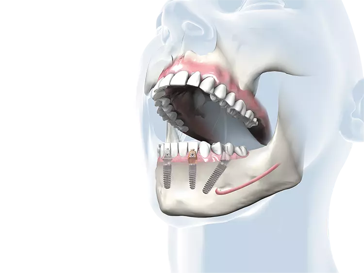 .